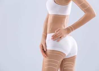 A Criolipólise, técnica não invasiva de combate à gordura localizada, é cada vez mais procurada pelas mulheres