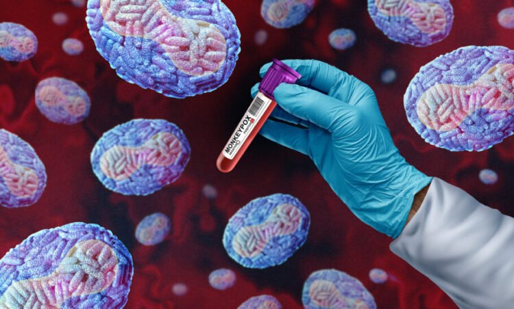 Governo de SP reforça cuidados e monitoramento contra a Mpox