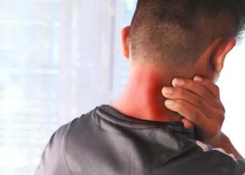 Julho Verde: como prevenir o câncer de cabeça e pescoço, que afeta milhões de brasileiros